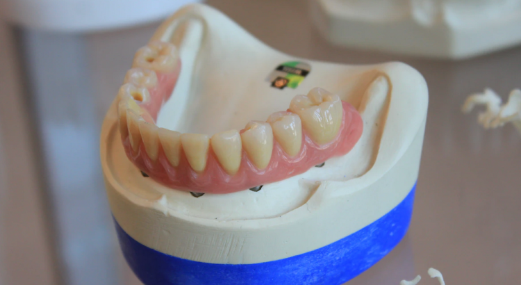 dentures on white scale rack